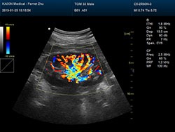 DCU50 – Portable Color Doppler Ultrasound System