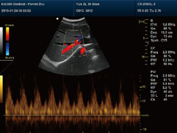 DCU50 – Portable Color Doppler Ultrasound System