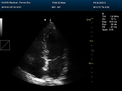 DCU50 – Portable Color Doppler Ultrasound System